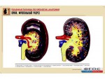 Рельефная таблица "Почка. Фронтальный разрез" (формат А1, матовое ламинирование) - fgospostavki.ru - Екатеринбург