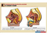 Рельефная таблица "Таз мужской и женский" (формат А1, матовое ламинирование) - fgospostavki.ru - Екатеринбург