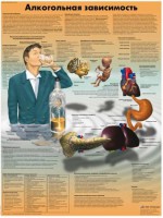 Плакат "Алкогольная зависимость" ламинированный - fgospostavki.ru - Екатеринбург