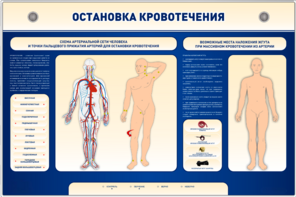 Электрифицированный стенд-тренажер "Остановка кровотечения" - fgospostavki.ru - Екатеринбург